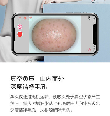 小米有品媄拾智能可視吸黑頭儀 告別黑頭，開(kāi)啟“眼見(jiàn)為實(shí)”的清潔新時(shí)代